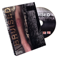 Bruised by Daniel Martin