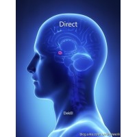 Direct by Bill Dekel