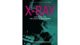 X-Ray by Ben Harris & Steve Shufton