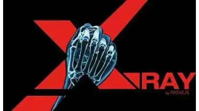 X-Ray by Rasmus
